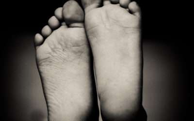 Often Misdiagnosed: Plantar Fasciitis