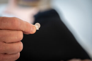 Microscopic Needles for Acupuncture for Alpha-Gal